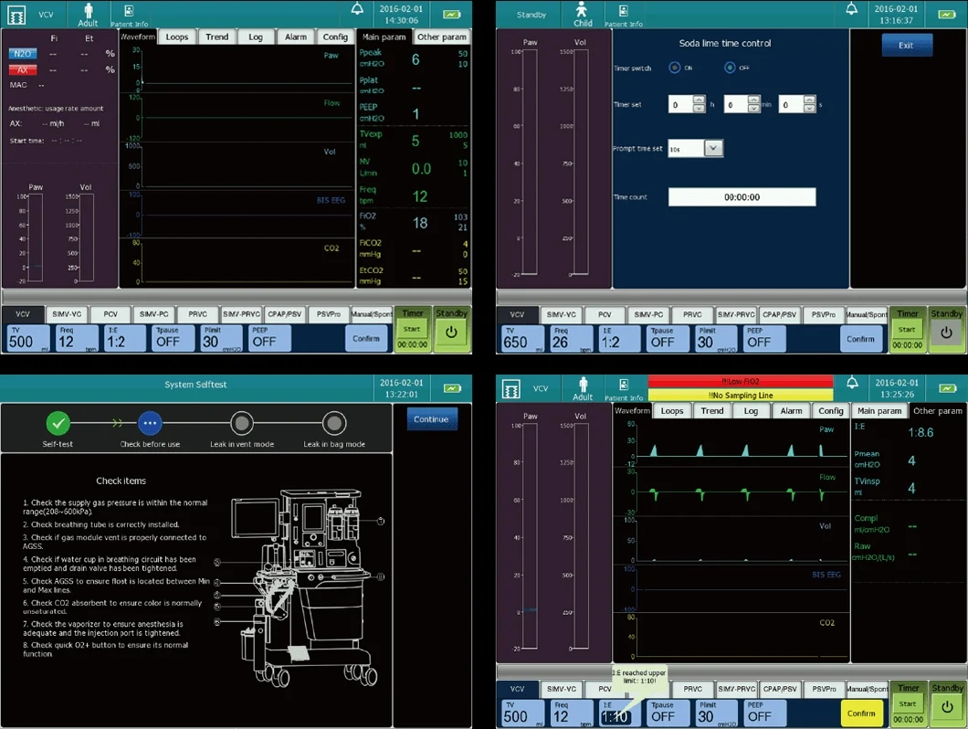 Medical Device Top Grade Trolley Anesthesia Machine with Workstation