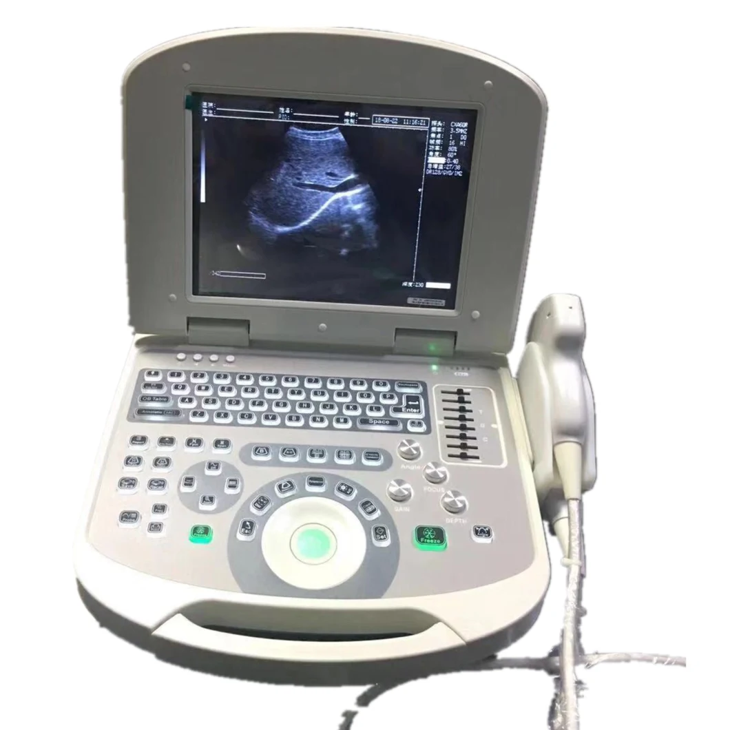 High-End Professional Hospital Trolley Ultrasound Scanner Machine