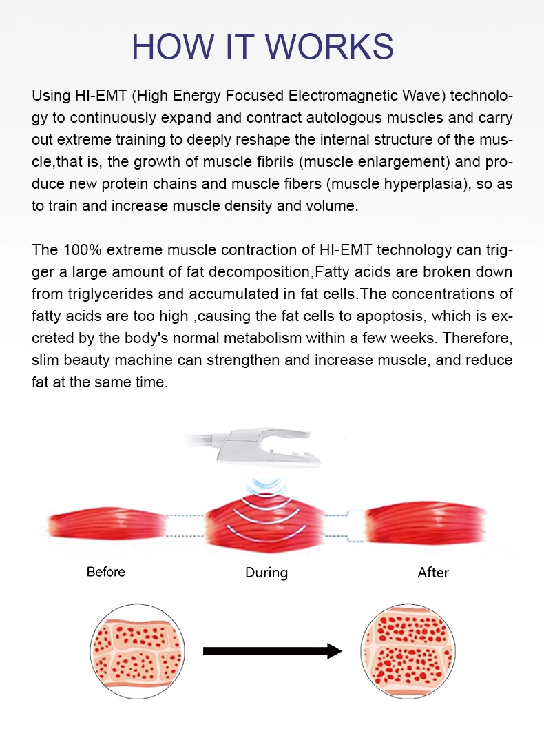 Lotuslaser 2021 Newest Weight Loss Slimming EMS Muscle Stimulator Sculpt Machine for Sale