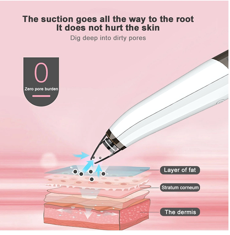 Rechargeable Face Vacuum Extractor Tool USB Vacuum Blackhead Remover