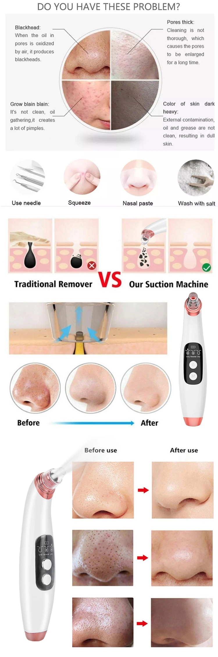 Acne Comedo Suction Tool Extractor Electric Facial Pore Cleaner Vacuum Blackhead Remover