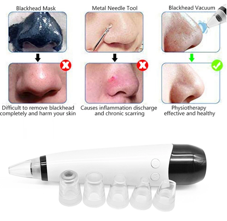 Rechargeable Face Vacuum Extractor Tool USB Vacuum Blackhead Remover