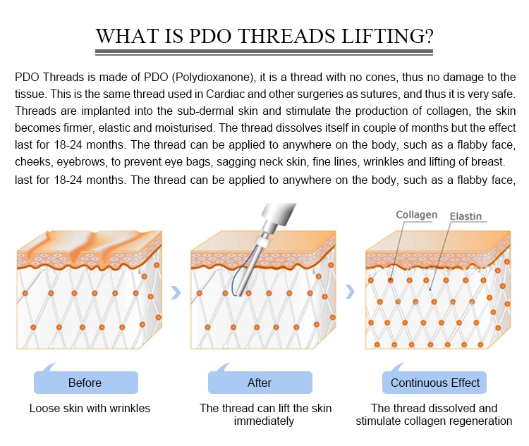 Mono 25g 50mm Absorbable Sutures Pdo Thread Lifting Mono for Medical Skin Tightening Face Lifting