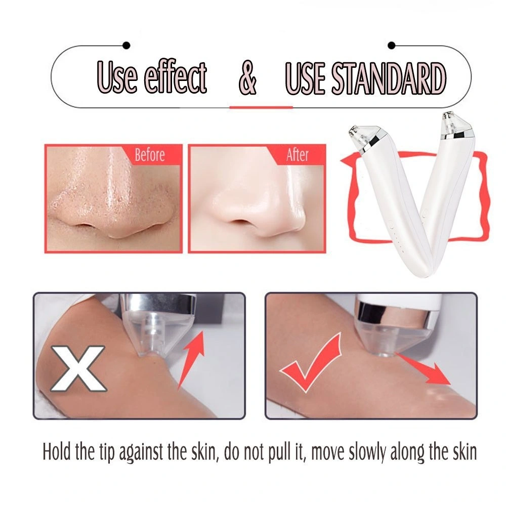 2020 New Best Selling Blackhead Acne Remover Facial Pore Deeply Cleaner Blackhead Remover