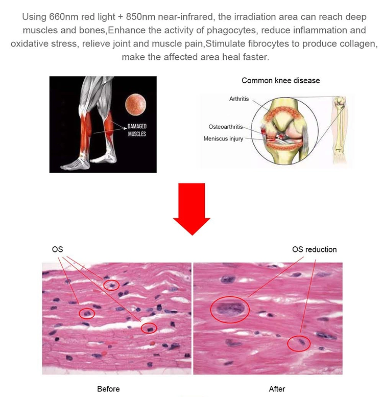 Body Skin Care Weight Management Red Light Therapy Capsule