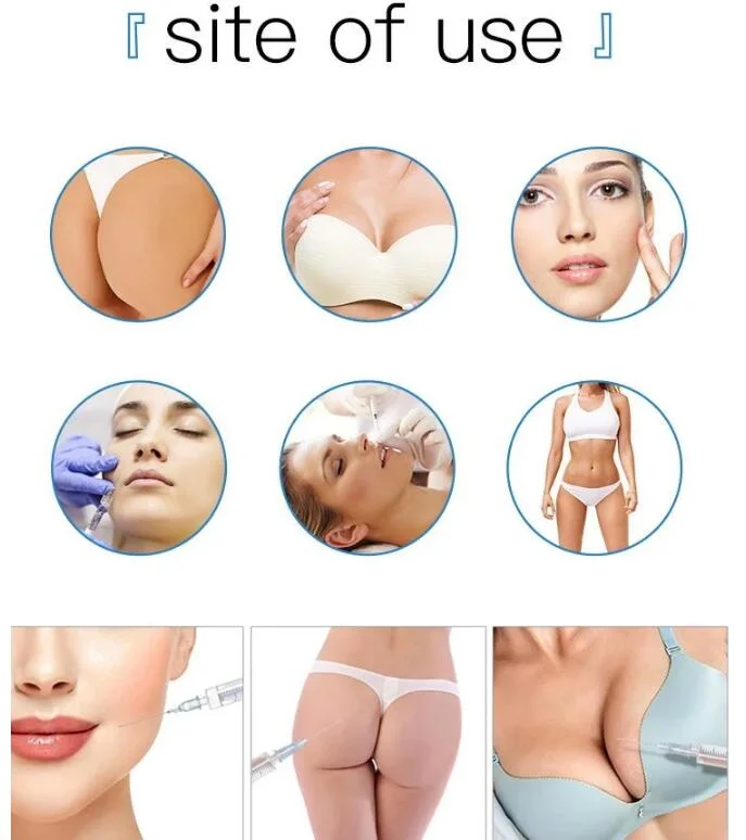 Injectable Face Fillers Dermal Fillers for Smile Lines Lips Eyes with Long Term Effects