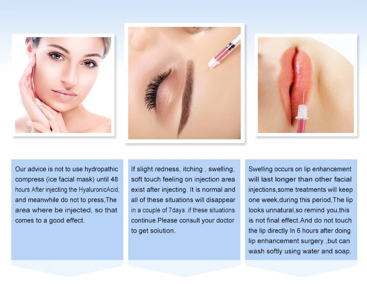 New Products Injectable 2 Ml Hyaluronic Acid Charmost Dermal Fillers Lip Fillers to Buy