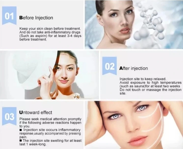 Clinic Used Injectable Ha Dermal Fillers Breast and Buttock Hyaluronic Acid Injection Dermal Fillers