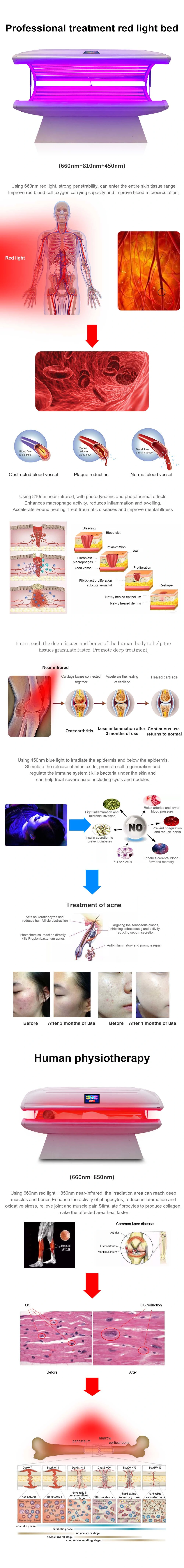 Full Body Skin Care Red Light Therapy Photobiomodulation Bed