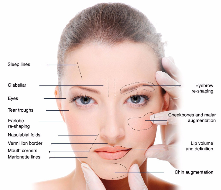 Hyaluronic Acid Filler Injectable Ha Dermal Filler Face Anti Aging