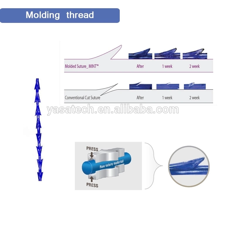 Thread Lifting Pdo Cog All Types of Pdo Thread Lift Cog Threads Pdo 3D 4D Cog Thread Lift