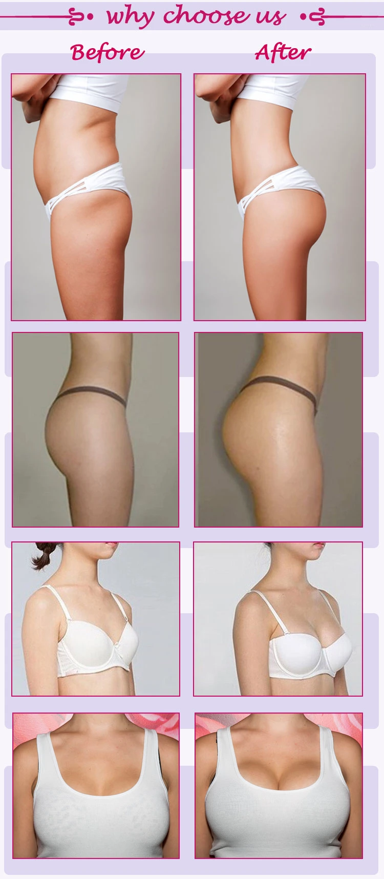 Innovative Product Gel Buttocks Enhancement Hyaluronic Acid Dermal Filler Injections 20ml