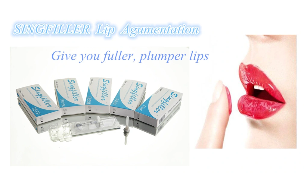 Singfiller Hyaluronic Acid Dermal Filler for Lip Filler (derm 1.0ml)