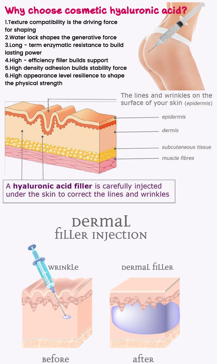 Innovative Product Gel Buttocks Enhancement Hyaluronic Acid Dermal Filler Injections 20ml