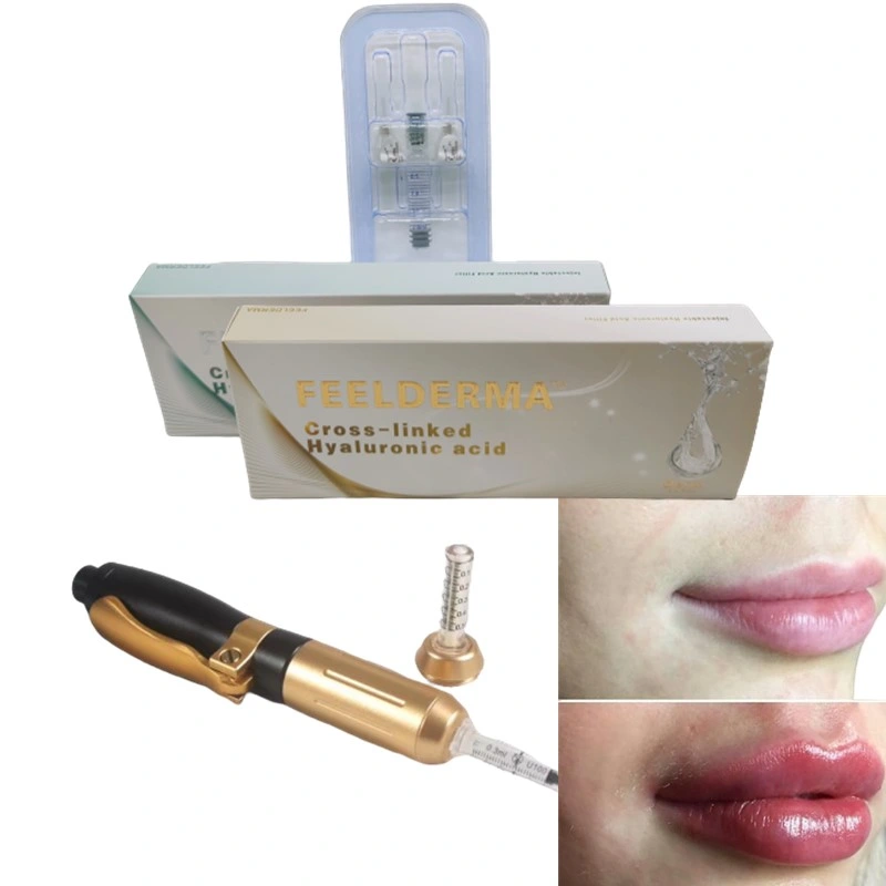 Cross-Linked Hyaluronic Acid Dermal Filler / Breast Injection/ Lip / Buttock Injection