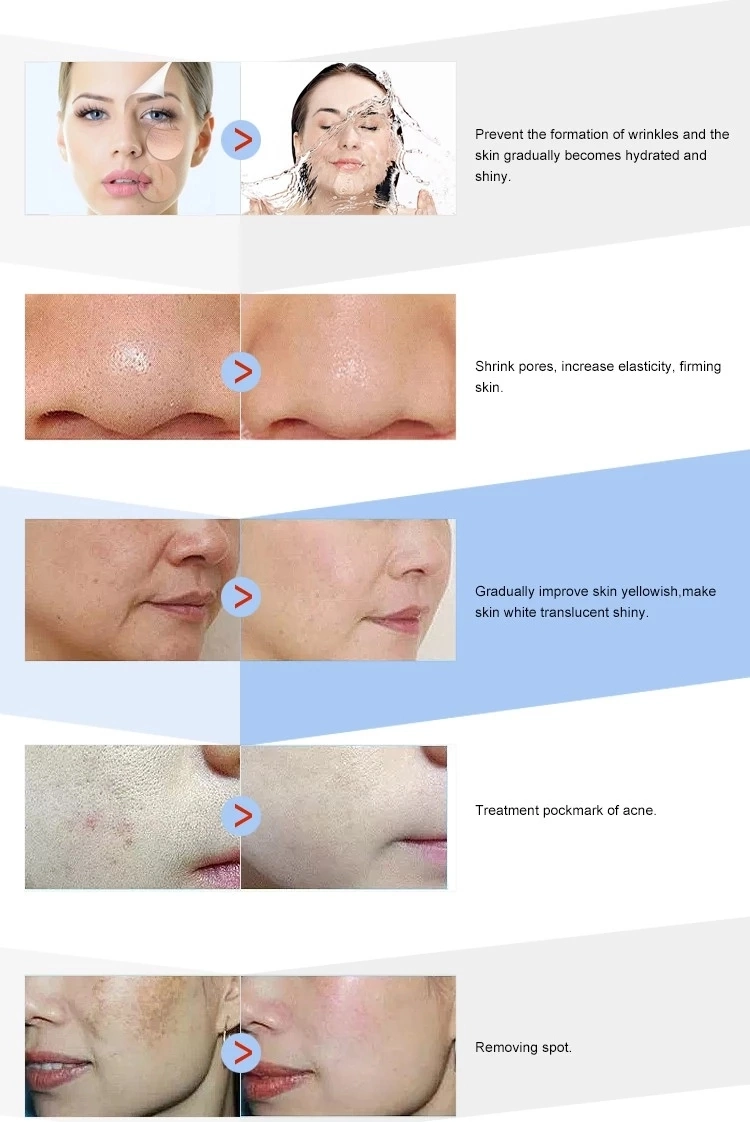 2ml Facial Beauty Ha Injection Meso Hyaluronic Acid for Face Lifting