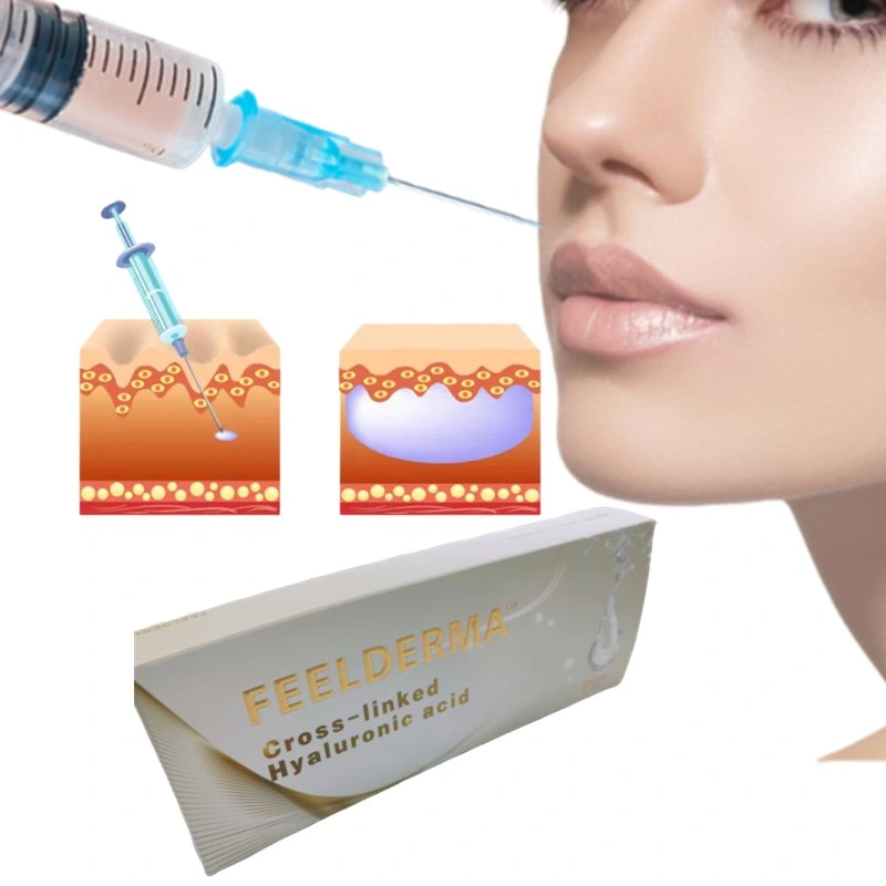 Cross-Linked Hyaluronic Acid Dermal Filler / Breast Injection/ Lip / Buttock Injection