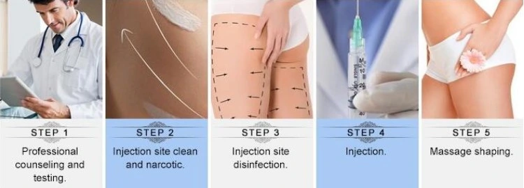 Skinject Injectable Gel Dermal Filler Ha Breast Buttock Penis Enhancement Filler 10ml