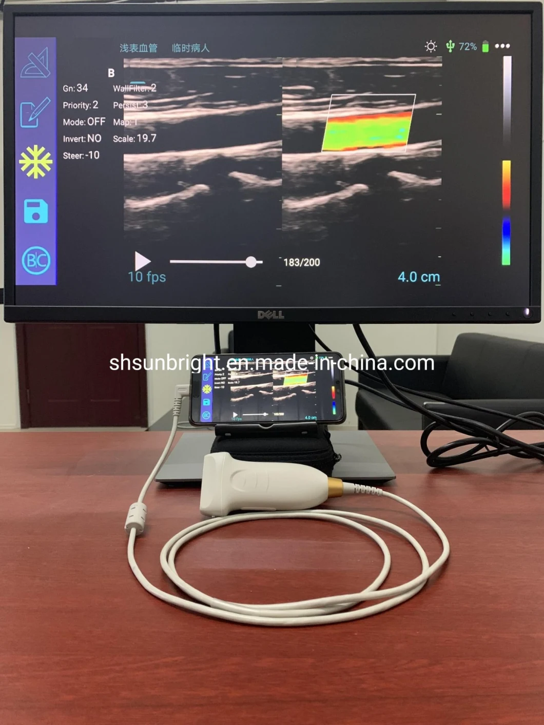 Transducer Ultrasound Linear USB Probe Color Doppler MHz Probe with 128 Elements