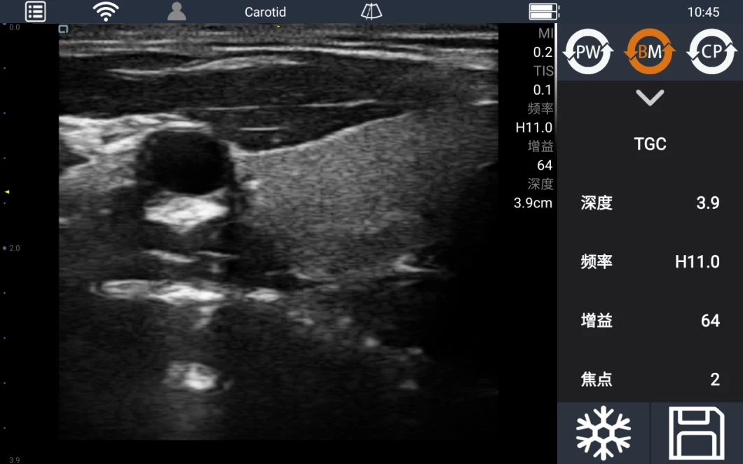 Mslvu48 Veterinary Wireless Ultrasound Probe Color Doppler Wireless Probe