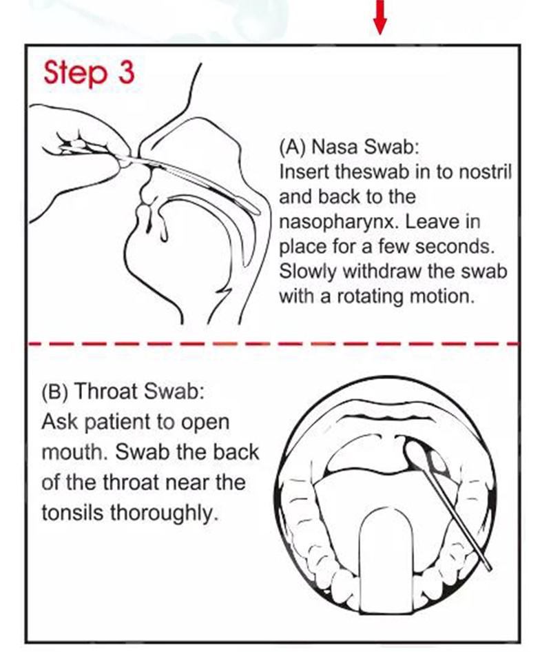 Nasopharyngeal Throat Flocked Swab Vtm Kit