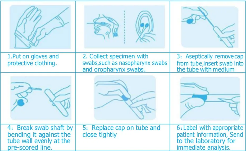 Transport Swab with Medium Canula Mouth Swab Sterile Pack Test Swab Tube Nasopharyng Swab