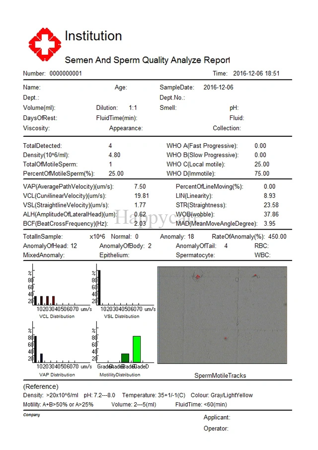 Hc-B028 Trolley Sperm Analysis Machine /Sperm Quality Analyzer Price/Computer Assisted Semen Analysis