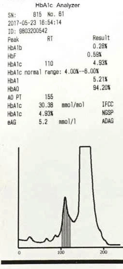 Medical Fully Automated Hba1c Analyzer, Hemoglobin Hba1c Analyzer