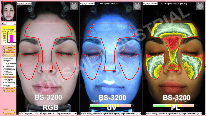 Skin Analyzer Skin Analysis Machine Facial Skin Analyzer for Facial Skin Analysis