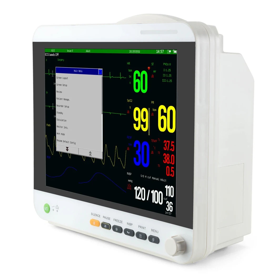 Sinnor Veterinary Monitor ECG Monitor Cardiac Monitor Ot Monitor Handheld Monitor Factory Manufacturer 15inch Snp9000ia ICU/Nicu/Ccu Monitor Bedside Monitor