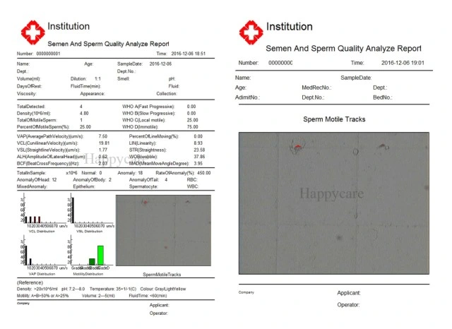 Hc-B028 Trolley Sperm Analysis Machine /Sperm Quality Analyzer Price/Computer Assisted Semen Analysis