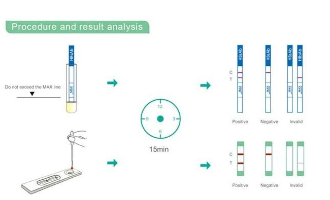 Various Shapes Diagnostic HCV Elisa Analyser Test