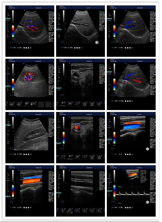 Portable Ultrasound Machine 3D/4D Color Doppler Ultrasound Equipment (YJ-C60)