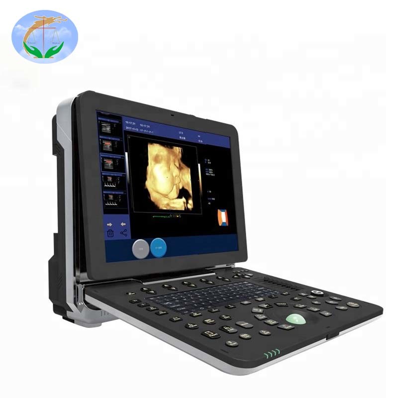 Medical Equipment Supply Portable Color Doppler Ultrasound Machine Ultrasound Scanner