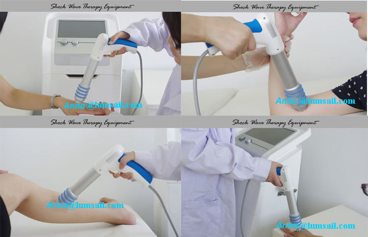 Shockwave Therapy Machine Physical Rehabilitation Shock Wave Medical Equipment