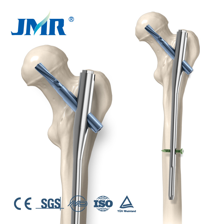 Titanium Orthopedic Implant Trauma Bone Plate Pfna Proximal Femoral Intramedullary Nail Antirotation
