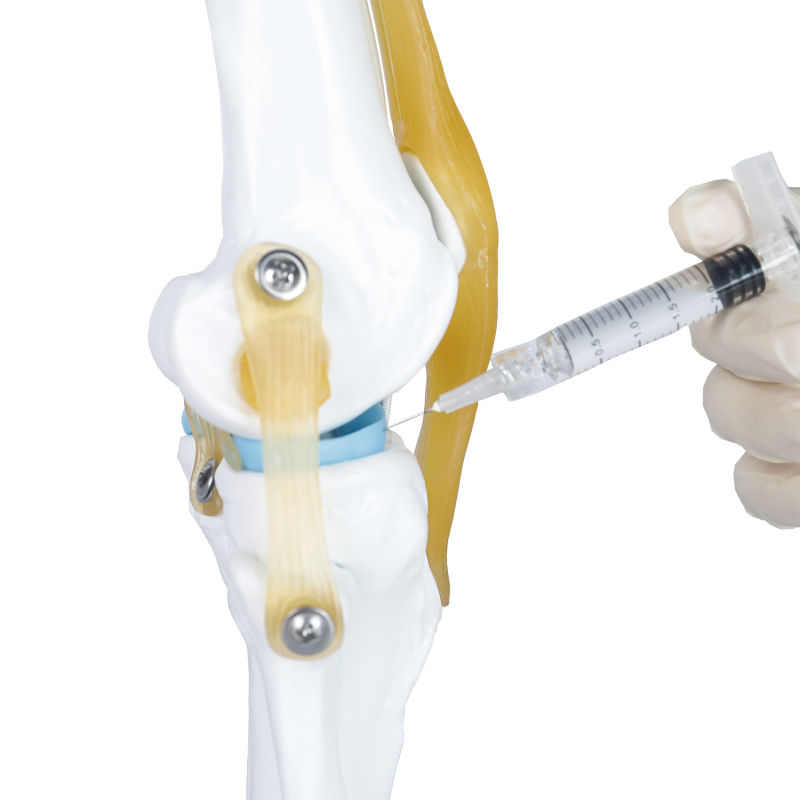 Orthopedic Implants of Hyaluronic Acid Gel Injection for Knee