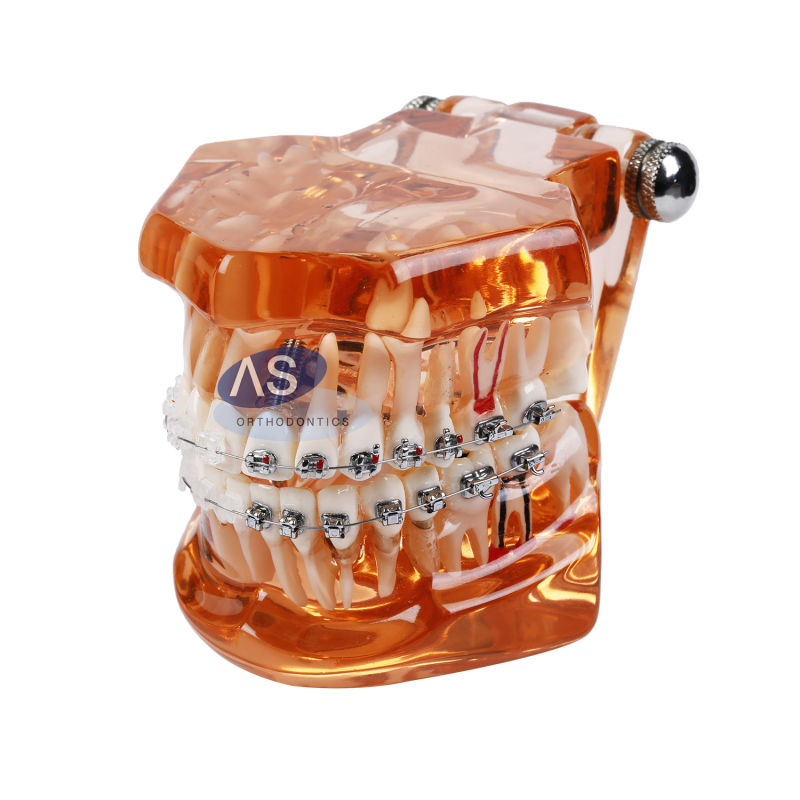 Orthodontic Self-Ligating Brackets Orthodontic Manufacturers Metal Brackets with Ce FDA ISO13485 2g