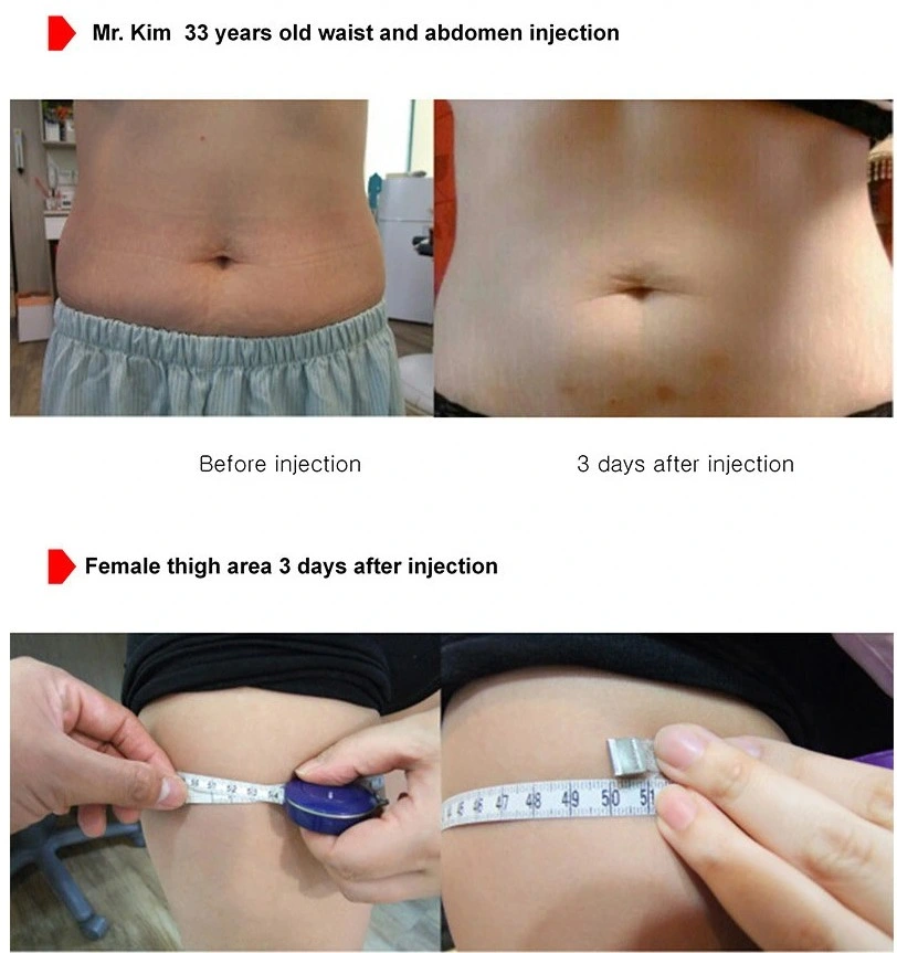 Cosmetic China Supplier Lipolytic Solution Mesotherapy 10ml Solution for Weight Loss Slimming Injection