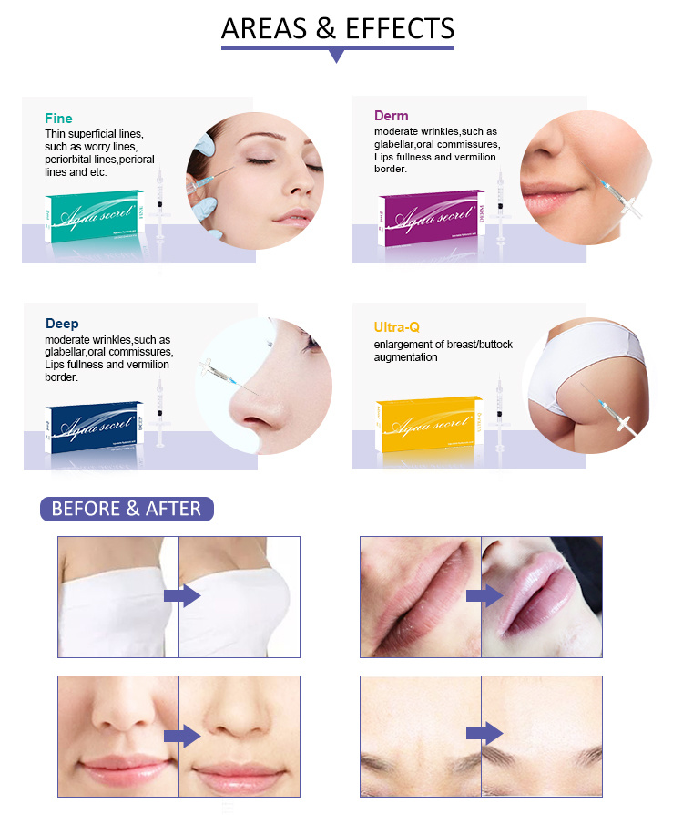 Wholesale Best Price of Hyaluronic Acid Hyaluronic