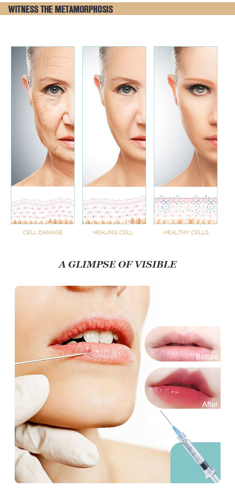 20ml Hyaluronic_ Acid_ Filler Filler Hyaluronic Acid Derm with Lido/Acid Hyaluronic Filler