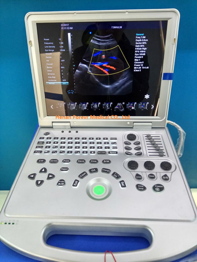 Medical Equipment 4D Color Doppler Ultrasonic Machine with Convex transducer