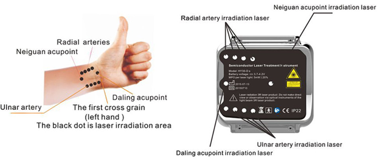 Low Level Laser Therapy Instrument Cardiovascular & Cerebrovascular Treatment Instrument