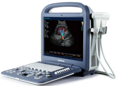 4D Ultrasound Medical Device Partable Doppler Scanner, USG Machine