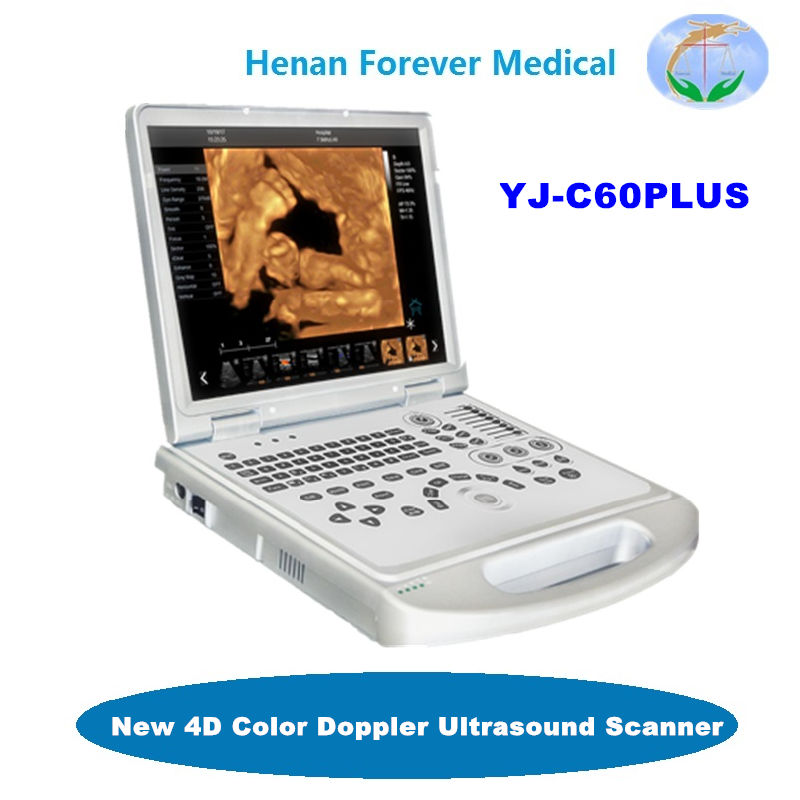 Medical Equipment 4D Color Doppler Ultrasonic Machine with Convex transducer