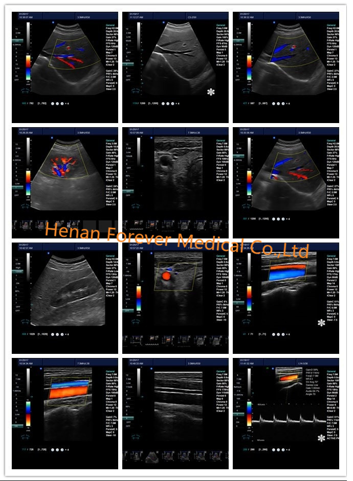 Medical Equipment 4D Color Doppler Ultrasonic Machine with Convex transducer