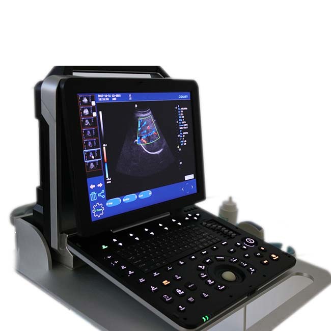 Gynaecology and Obstetrics Diagnostic Equipment 4D Color Ultrasound Scanner