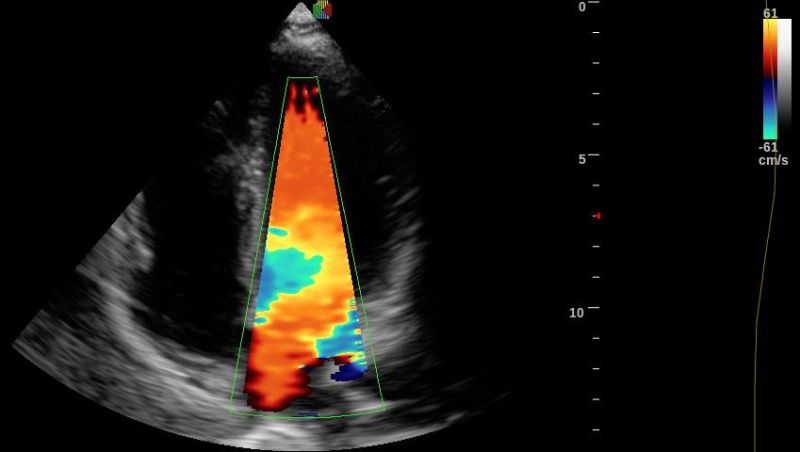 4D Ultrasound Medical Device Partable Doppler Scanner, USG Machine