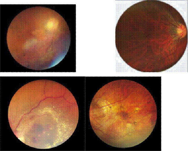 Handheld Digital Portable Eye Exam Fundus Camera