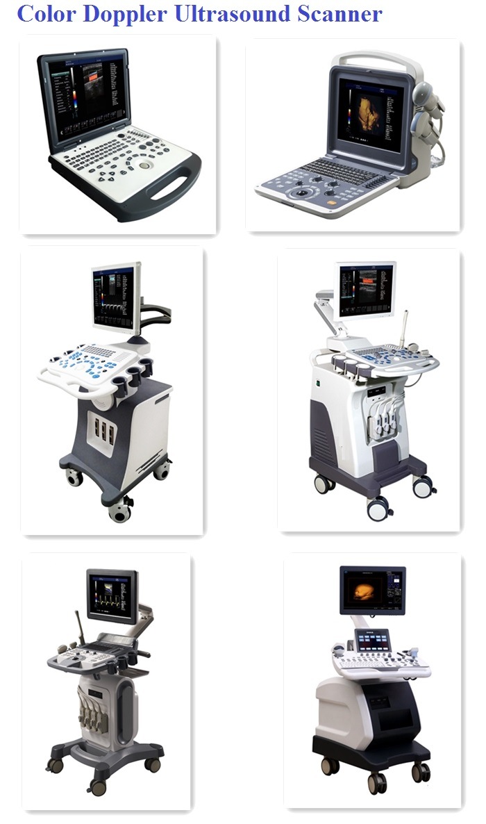 Opthalmic Ultrasound Scanner for Eyes a / B Ultrasound Scanner (HO-500)